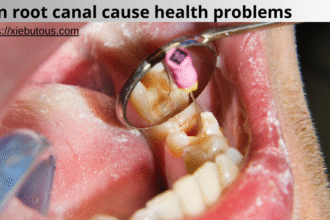 can root canal cause health problems