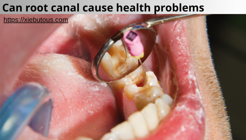 can root canal cause health problems